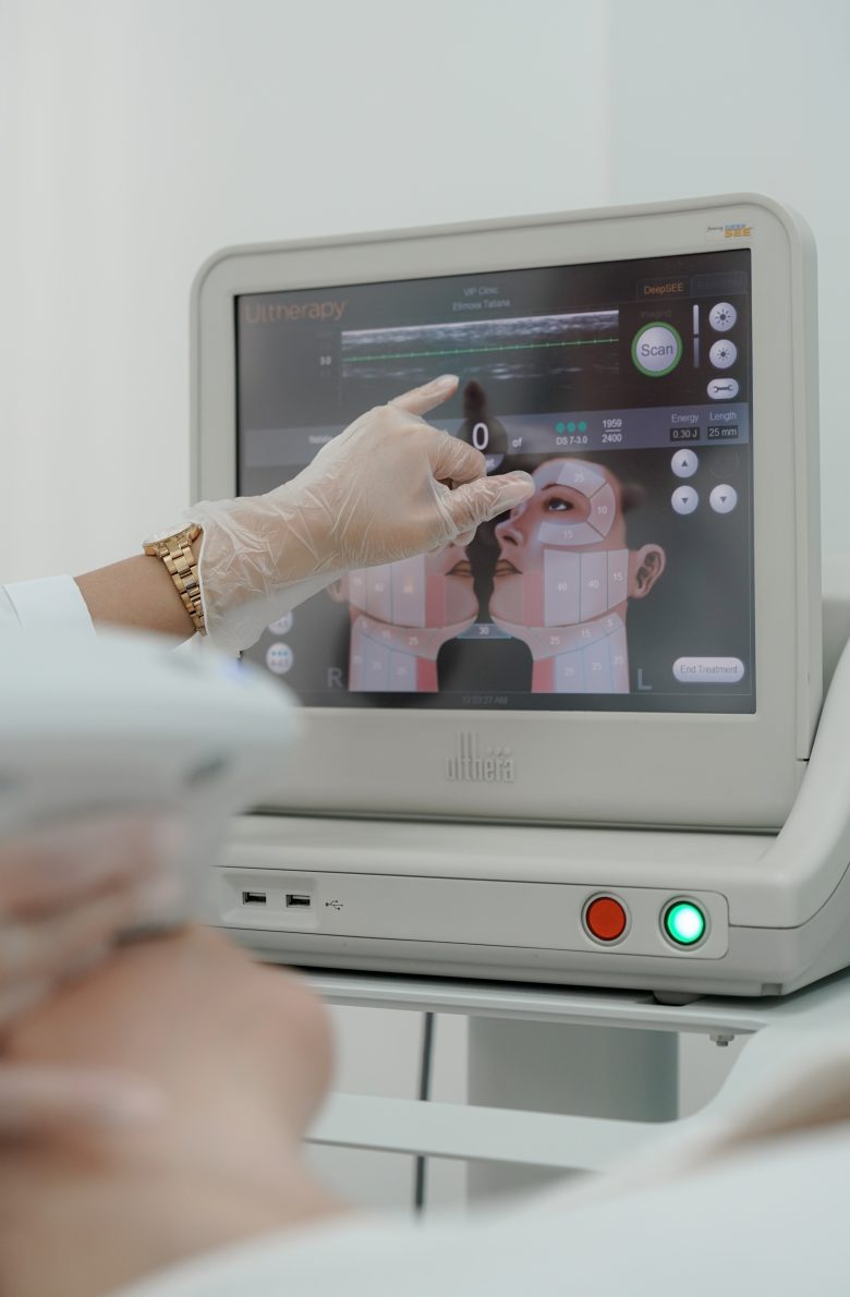 Ulthera System Альтера-терапия
