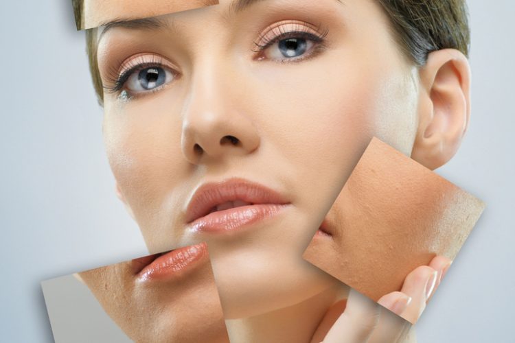 Пигментация на лице: как убрать с помощью косметологии