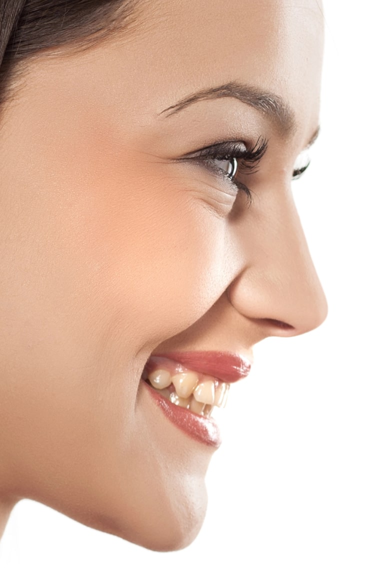 Ринопластика