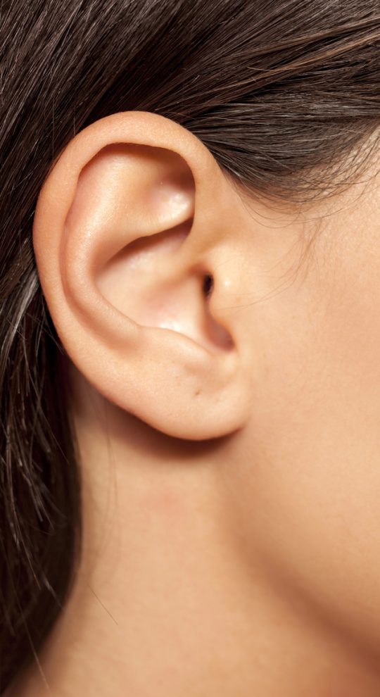 Отопластика