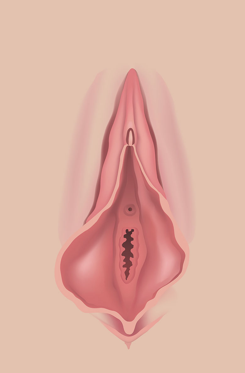 Пластика половых губ