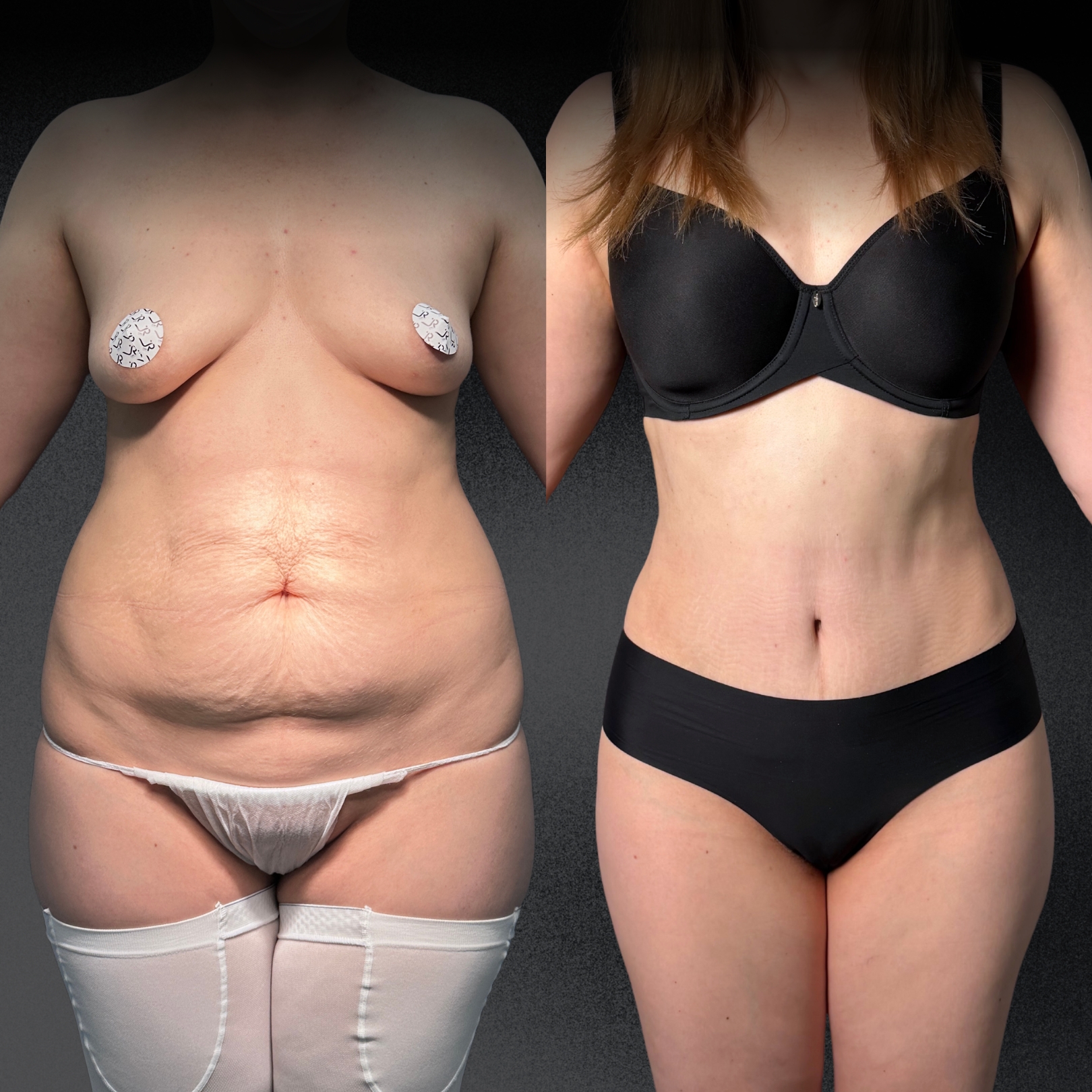 Выпуск 12 - «Оказывается, жизнь только начинается, у меня ещё всё впереди». История пациента Веры 01