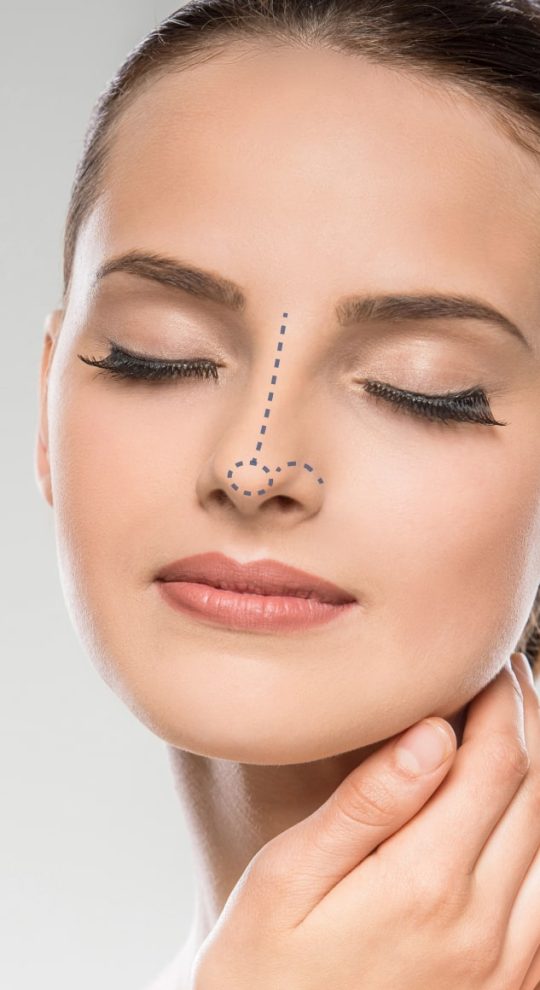 Ринопластика кончика носа