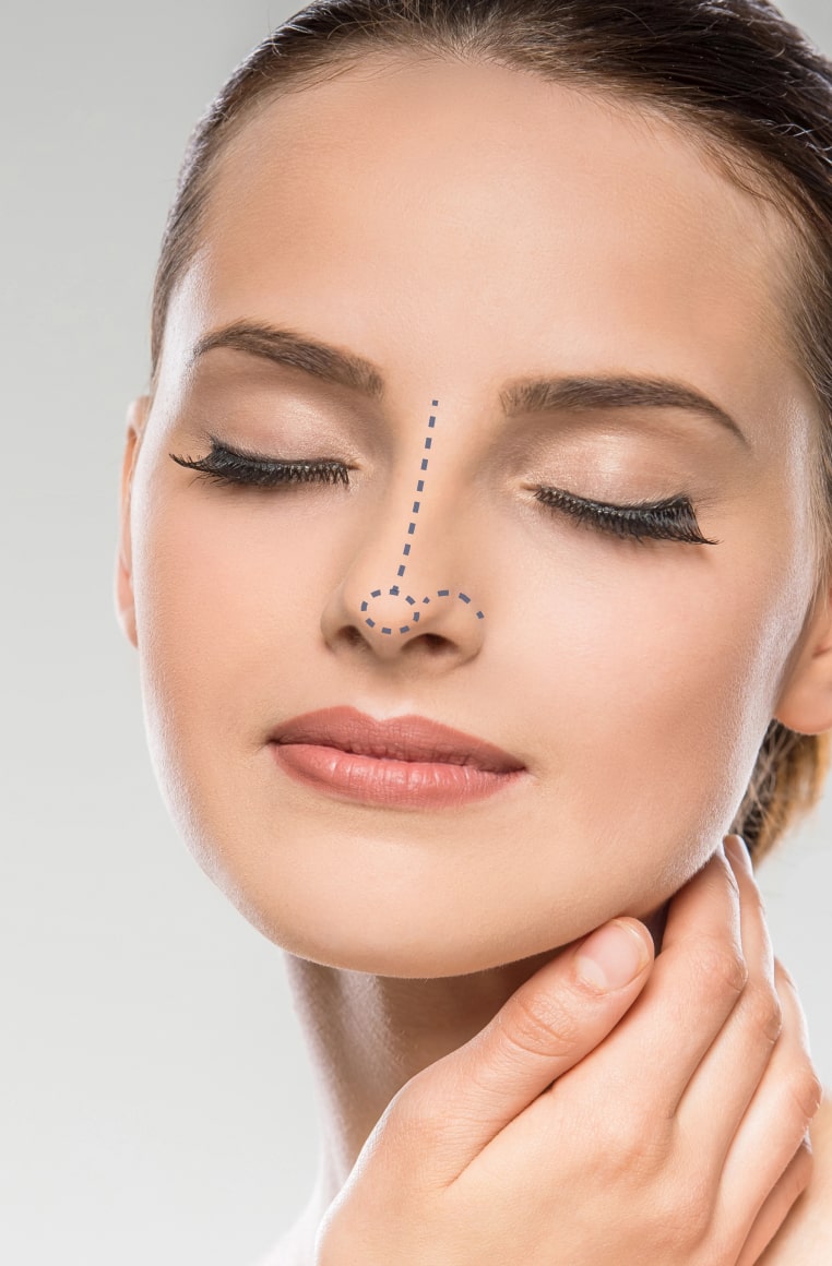 Ринопластика кончика носа