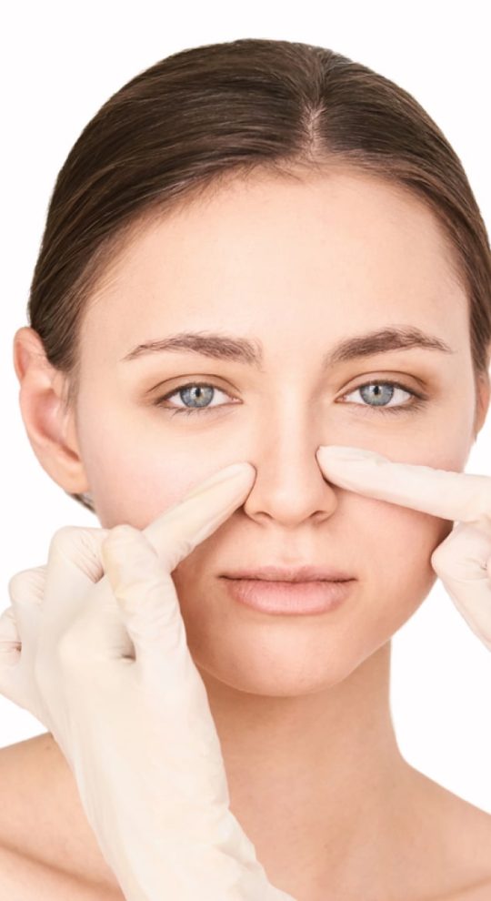 Вторичная ринопластика