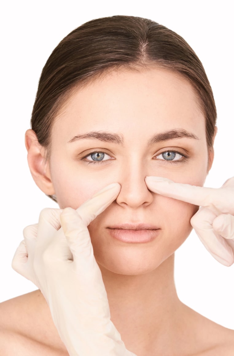 Вторичная ринопластика