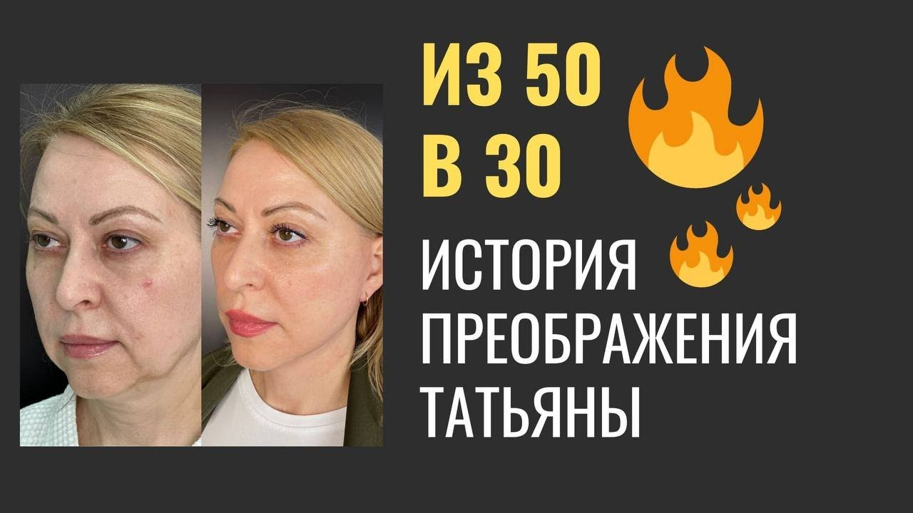 Выпуск 8 — «Хочется смотреть в зеркало». История пациента Татьяны