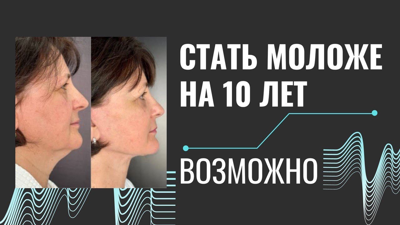 Выпуск 7 — «Стареть не хочется». История пациента Татьяны