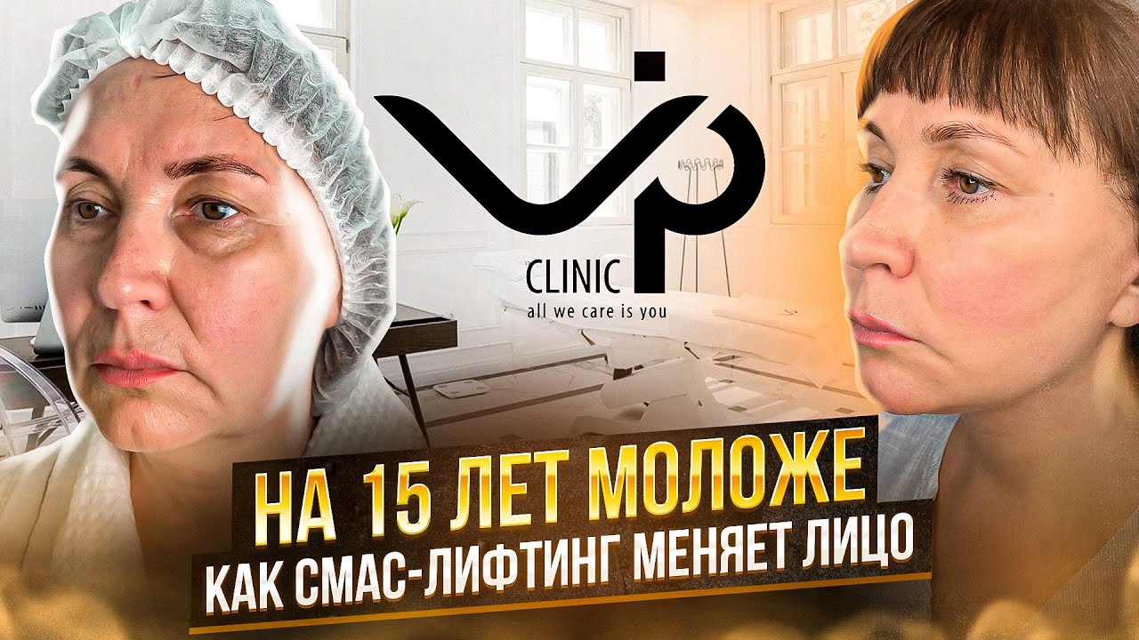 Выпуск 10 — «Оказывается, жизнь только начинается, у меня ещё всё впереди». История пациента Веры