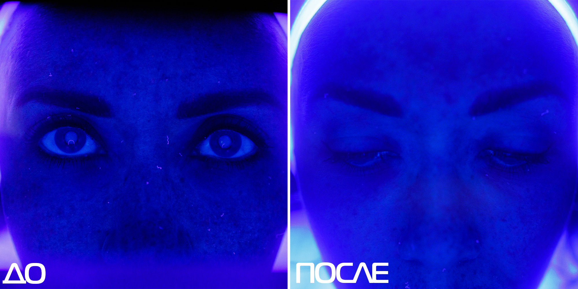 Скажи пигментации «НЕТ» 01