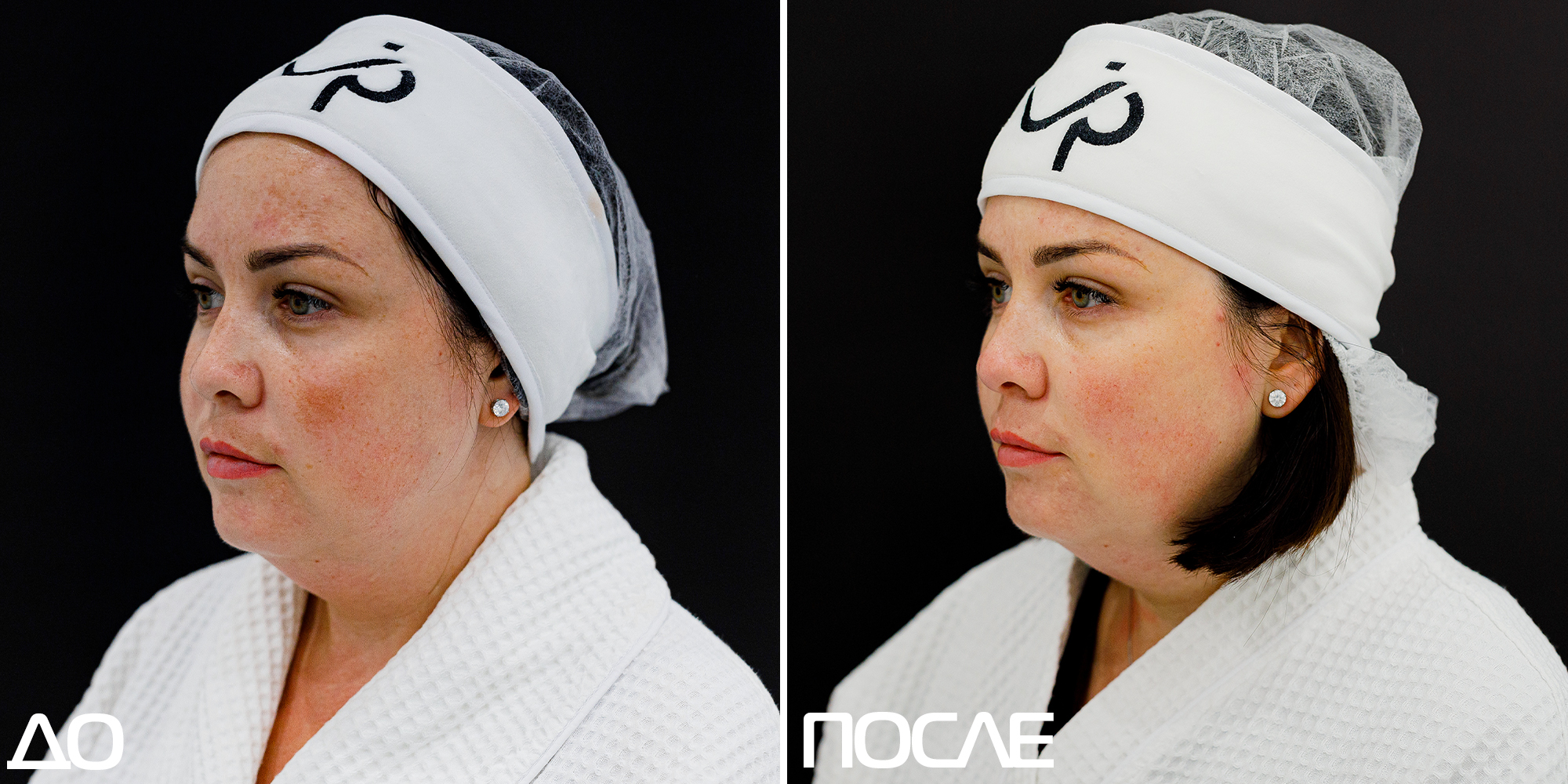 Скажи пигментации «НЕТ» 01