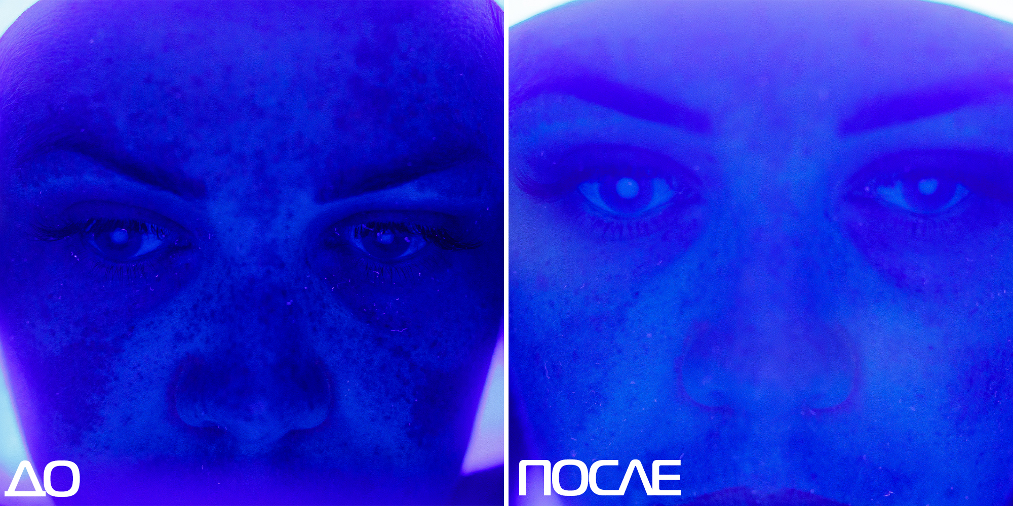 Скажи пигментации «НЕТ» 01