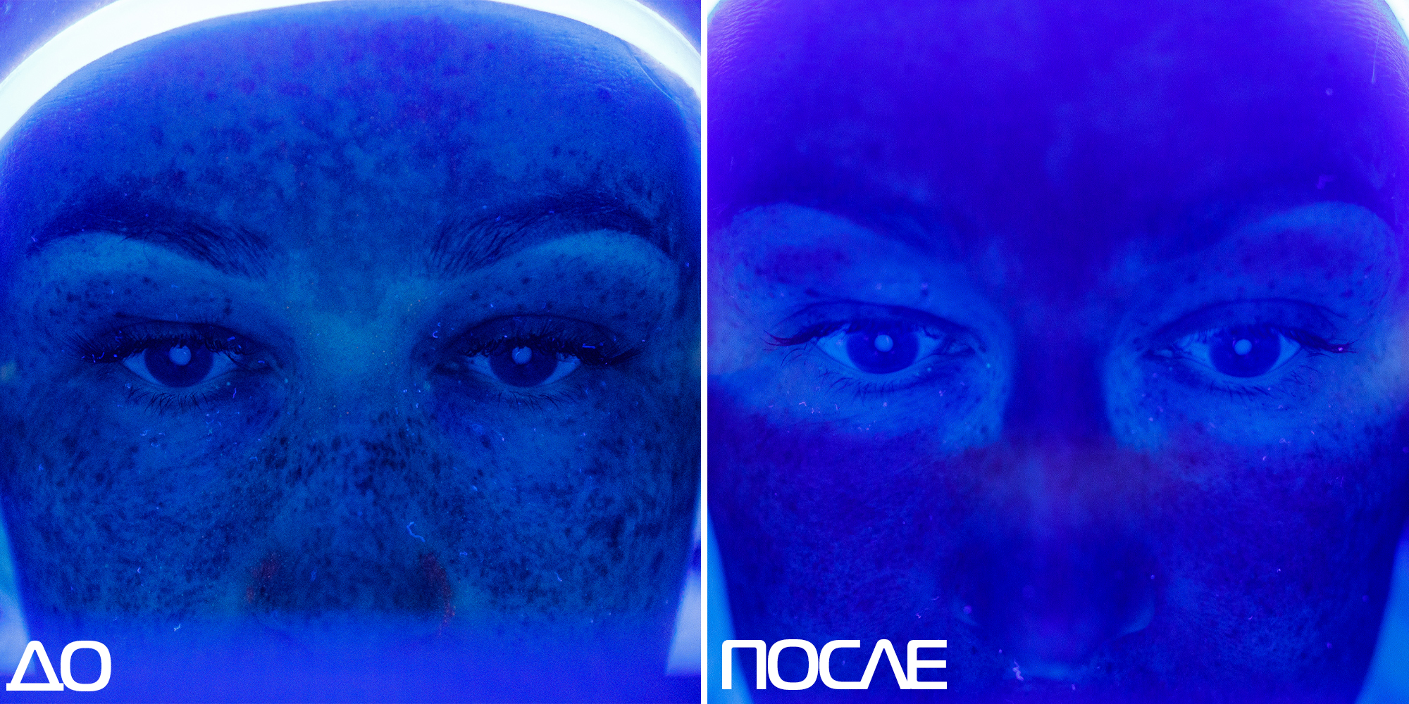 Скажи пигментации «НЕТ» 01