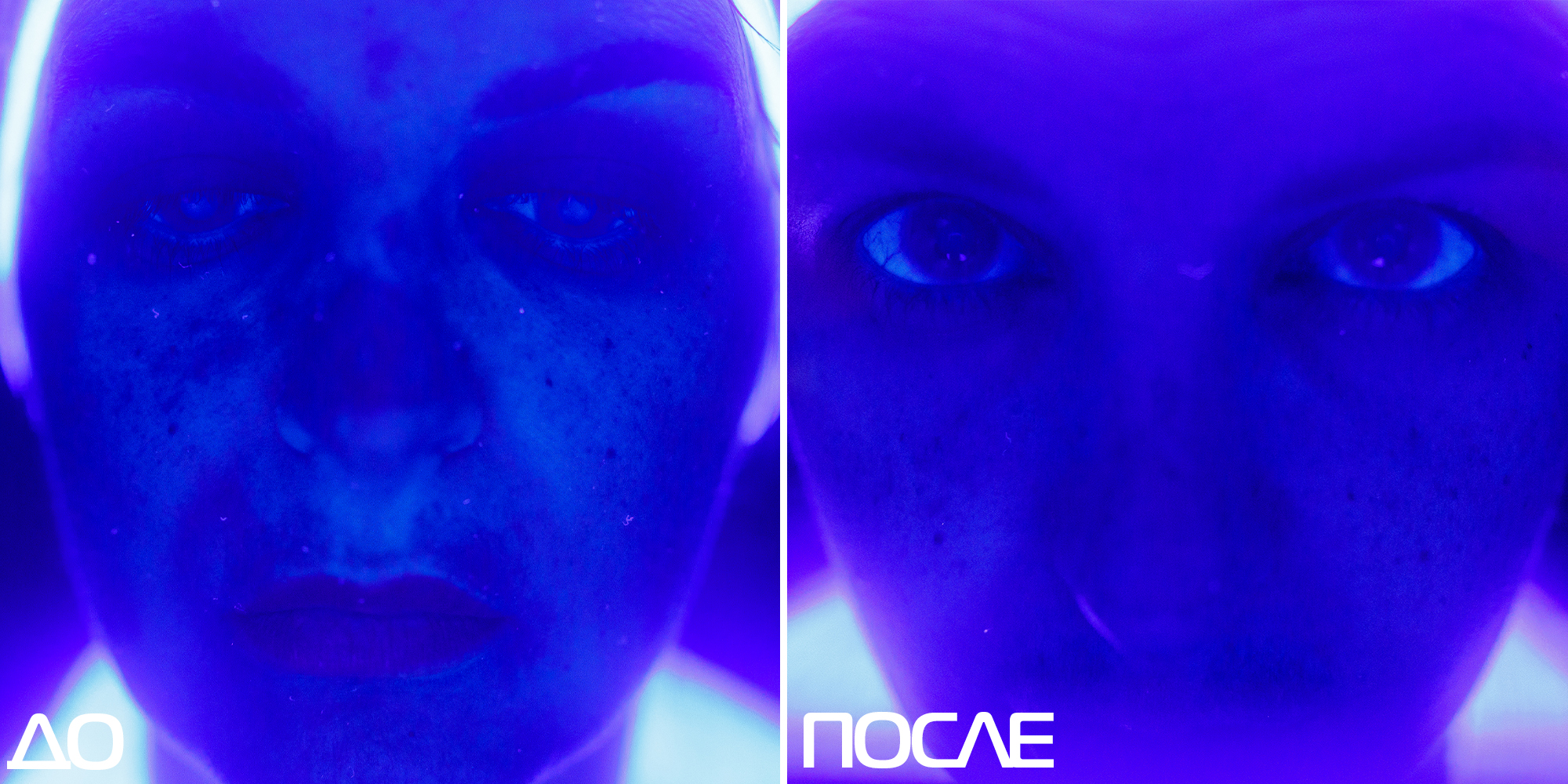 Скажи пигментации «НЕТ» 01