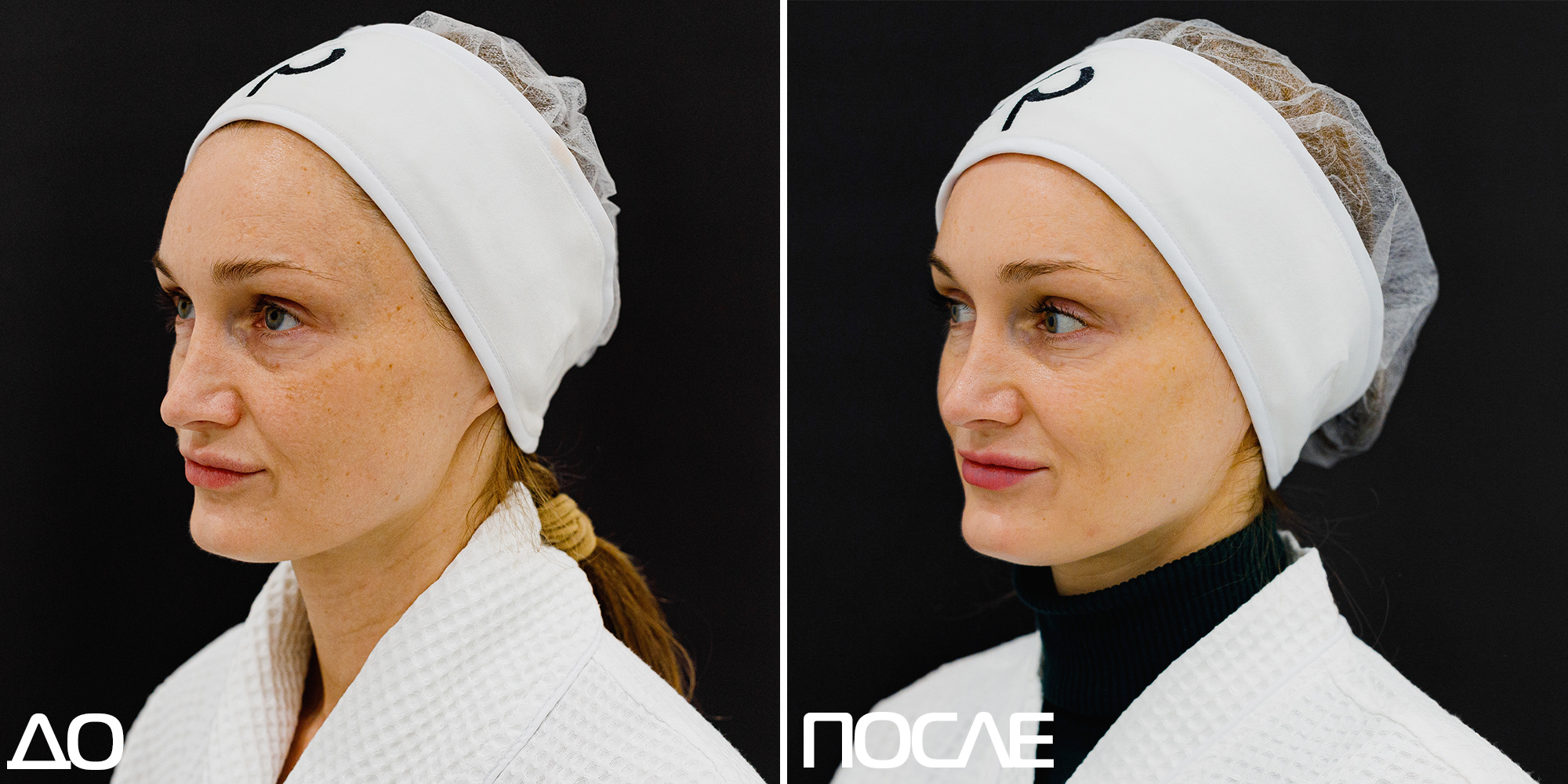 Скажи пигментации «НЕТ» 01
