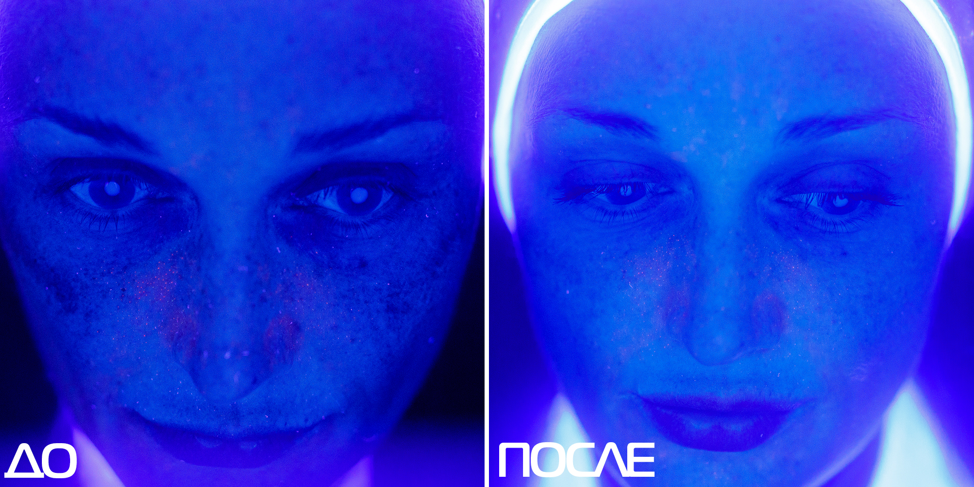 Скажи пигментации «НЕТ» 01
