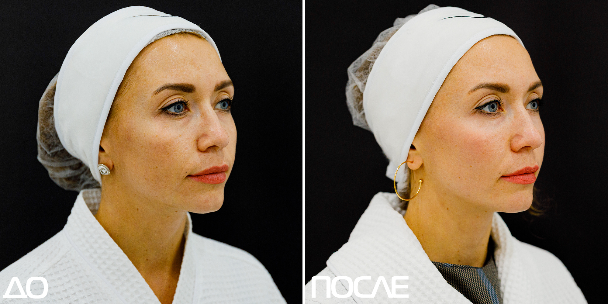 Скажи пигментации «НЕТ» 01