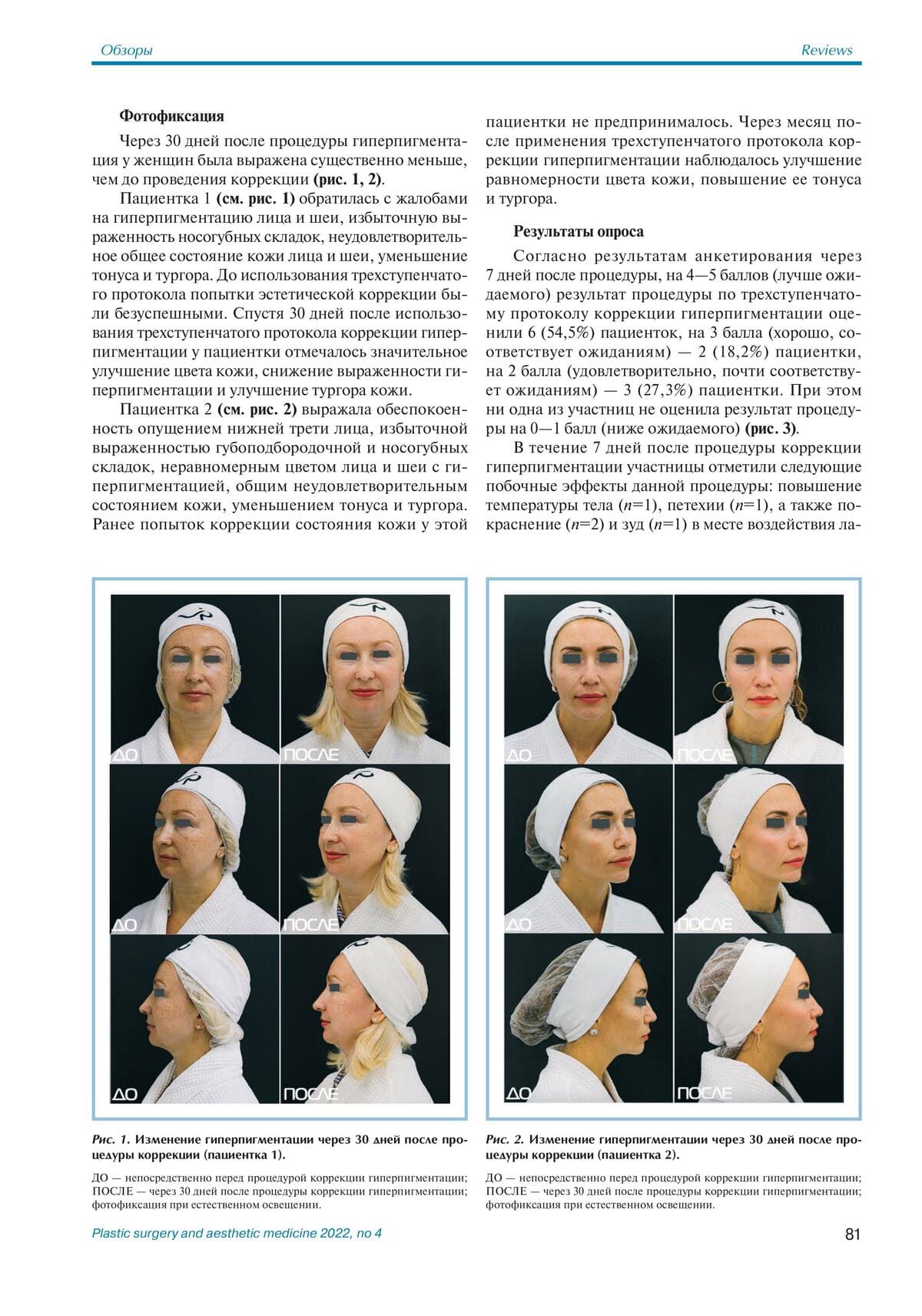 Скажи пигментации «НЕТ» 05