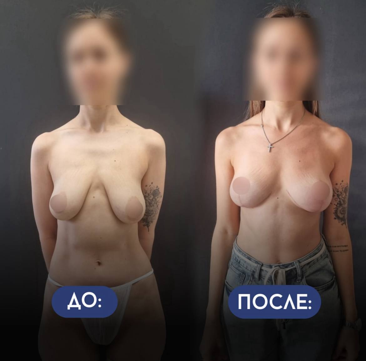 Грудь для мам 01