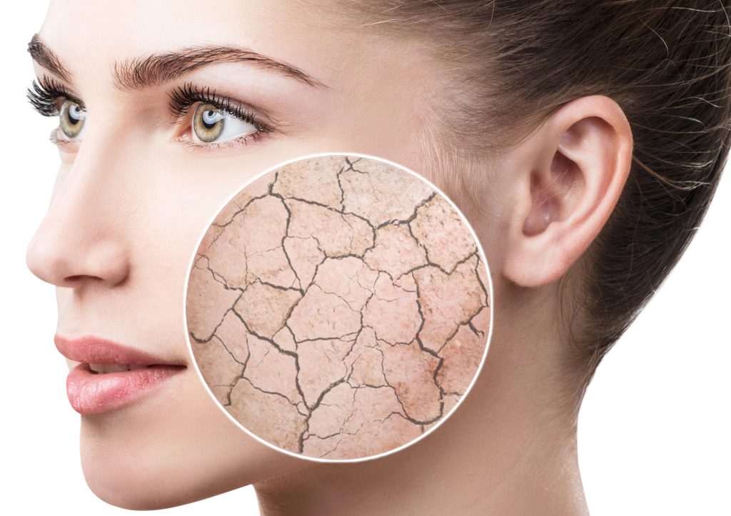 Врач рассказала, какие заболевания кожи обостряются в осенне-зимний период