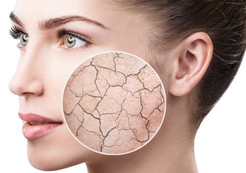 Врач рассказала, какие заболевания кожи обостряются в осенне-зимний период