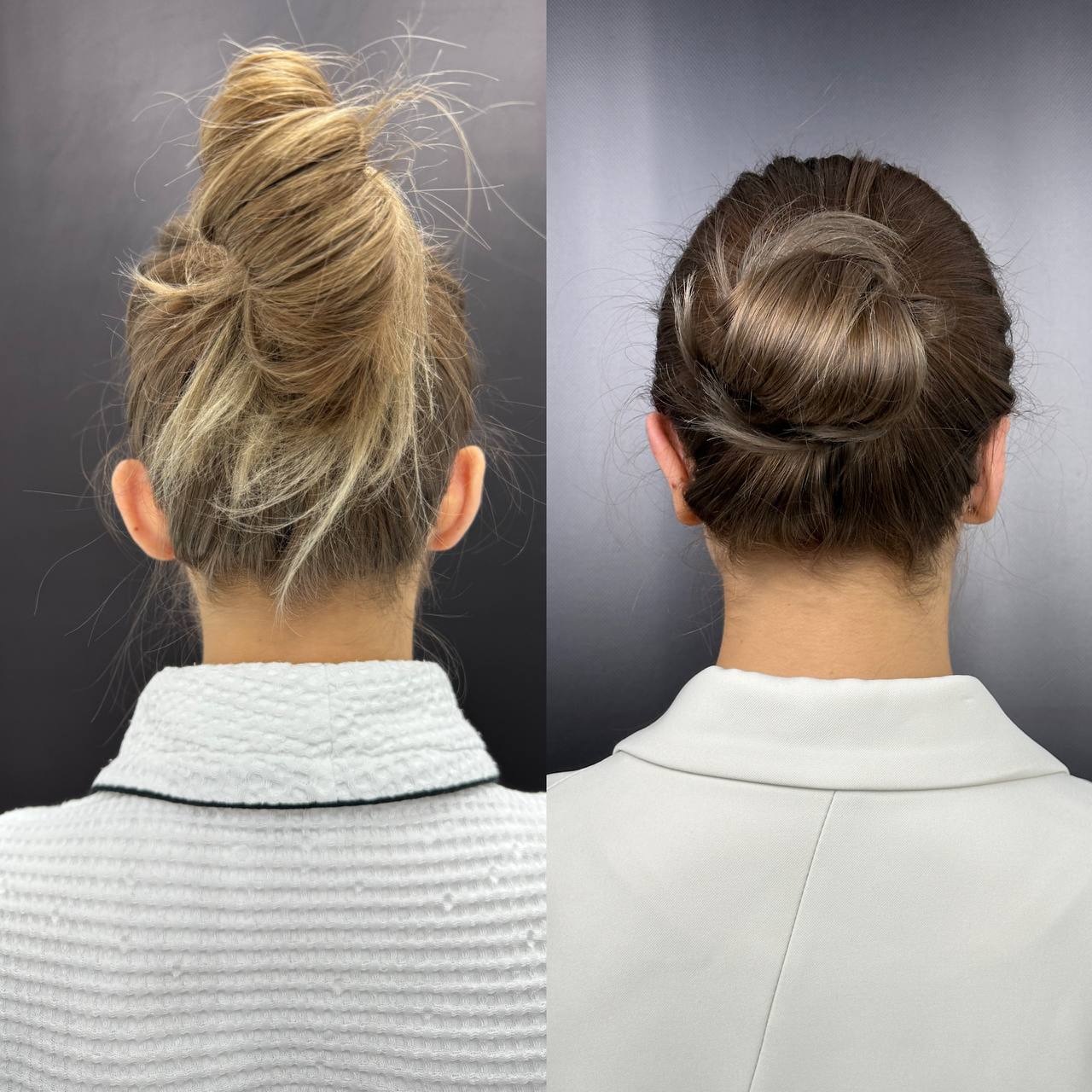 Выпуск 12 - Милые ушки или ненавистные уши? История пациента Елены 06