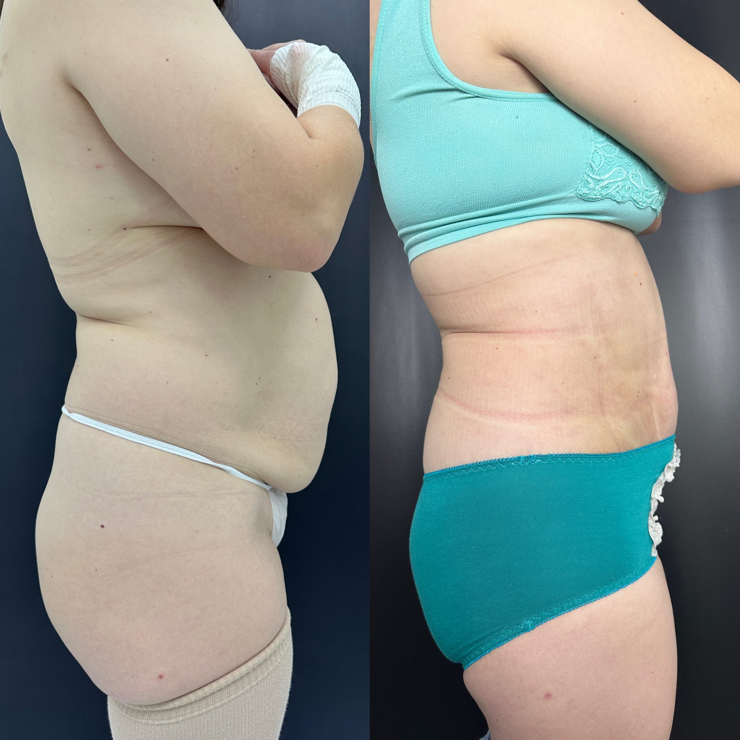 Выпуск 15 - «Хочу, чтобы дети меня видели красивой». История пациента Юлии 03