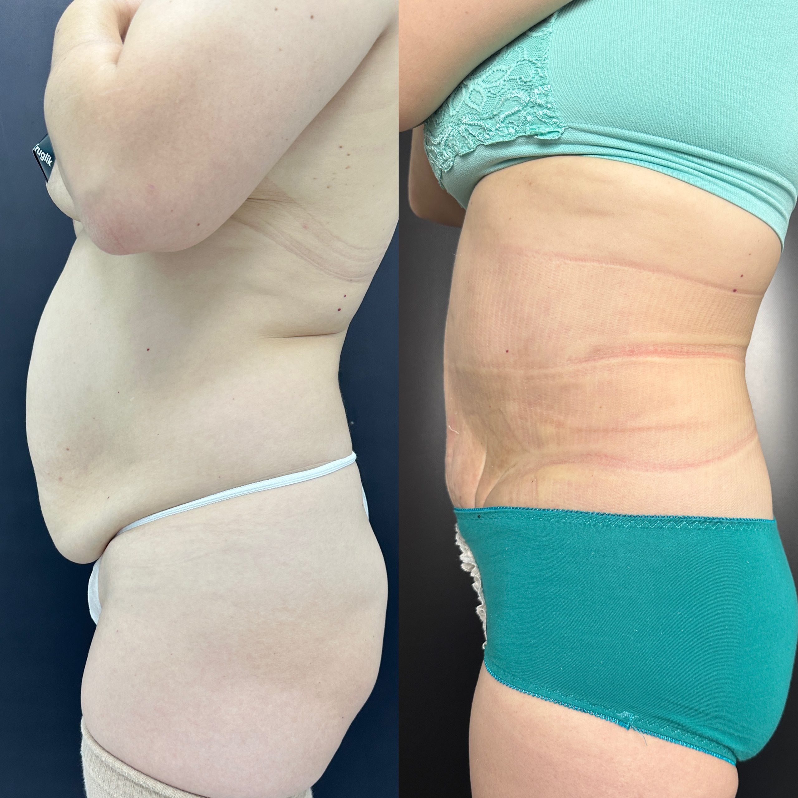 Выпуск 15 - «Хочу, чтобы дети меня видели красивой». История пациента Юлии 05