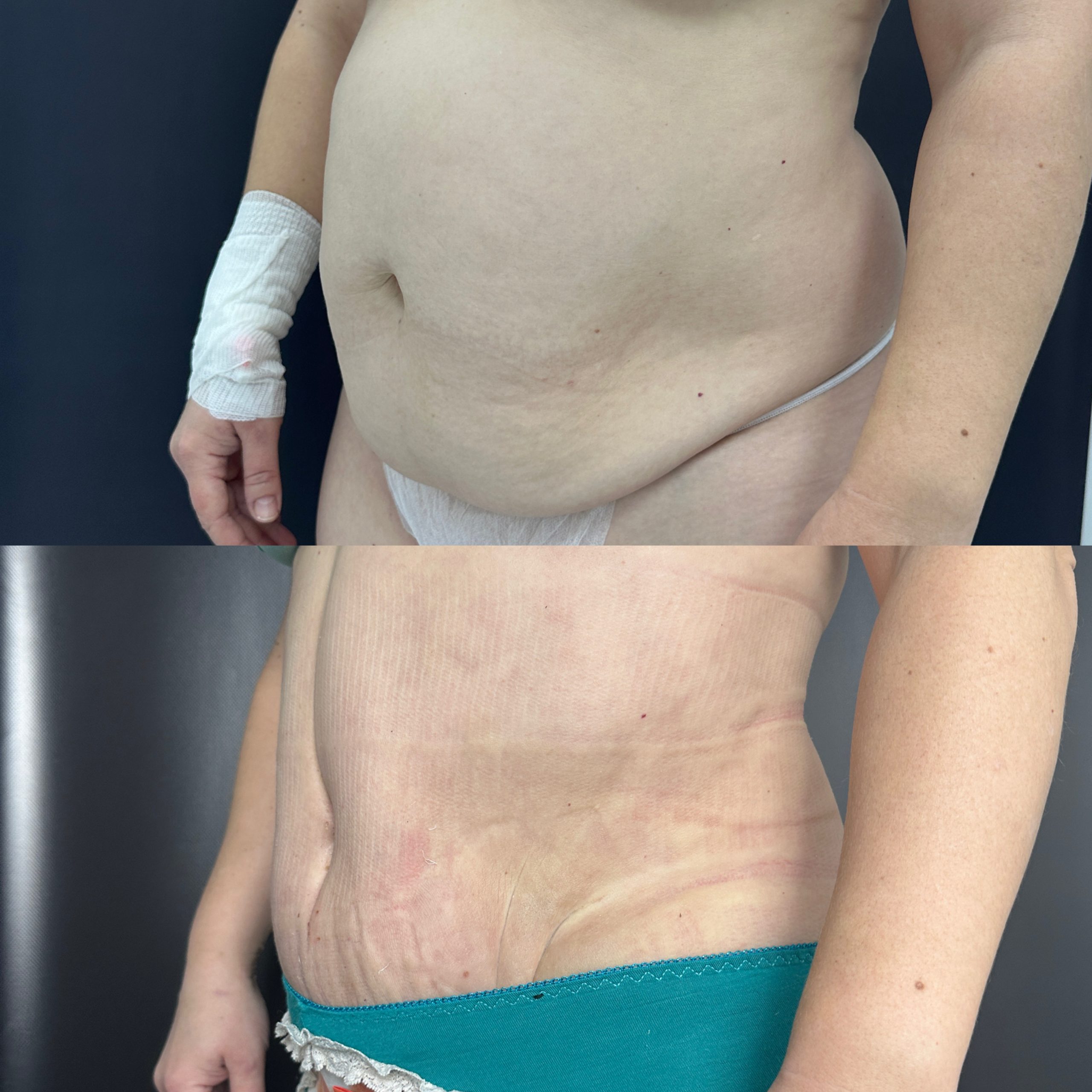 Выпуск 15 - «Хочу, чтобы дети меня видели красивой». История пациента Юлии 06