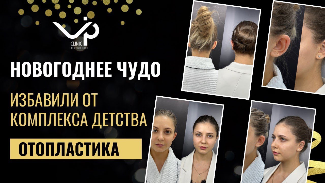 Выпуск 12 — Милые ушки или ненавистные уши? История пациента Елены