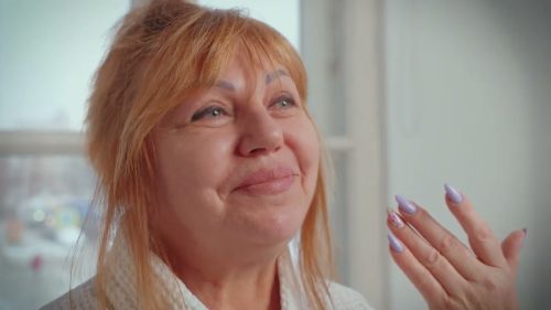 Выпуск 16 — SMAS-лифтинг. История пациента Елены