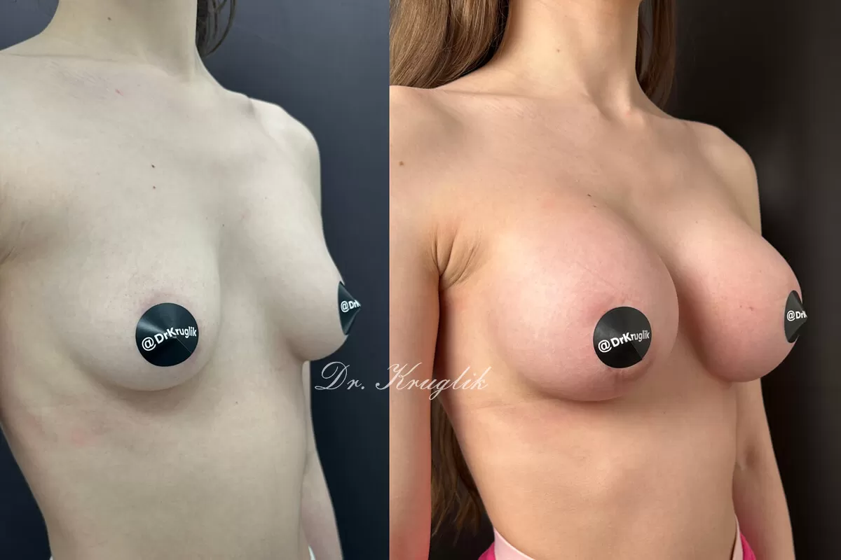 Выпуск 14 - «Нет страха, есть мечта». История пациента Евгении 02