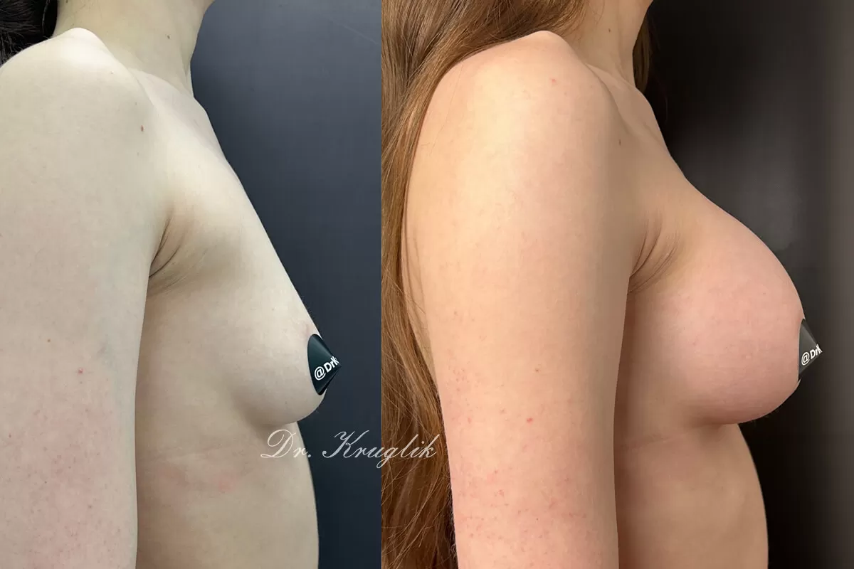 Выпуск 14 - «Нет страха, есть мечта». История пациента Евгении 03