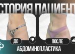 Выпуск 18 — «Я себя ощущаю так, как никогда не ощущала» История пациента Айсель
