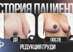 Выпуск 19 — «Эта операция избавит меня от многих неприятных историй и откроет новую жизнь» История пациента Карины