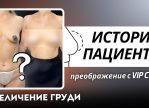 Выпуск 21 — «Мне нравится моя грудь, нравится ее трогать» История пациента Виктории